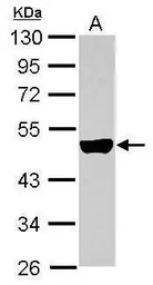 Cytokeratin 33B antibody