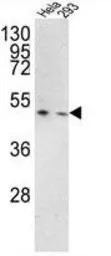 TMPRSS3 antibody, Internal