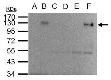 HIF1 alpha antibody [GT10211]