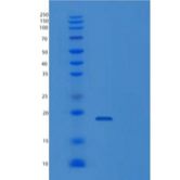 人白细胞介素-25/IL25/MYDGF重组蛋白N-6His