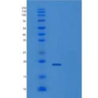 人白细胞介素-25/IL25/MYDGF重组蛋白N-6His