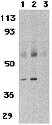 CCR3 antibody