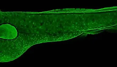 Alpha 2 Antiplasmin antibody [