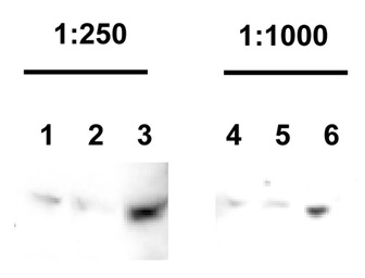 Parkin antibody