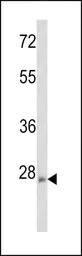 Rho 8 antibody, Internal