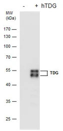 TDG antibody [GT622]
