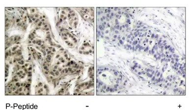 NFkB p105/p50 (phospho Ser337)