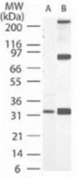 Caspase 3 antibody [31A1067]