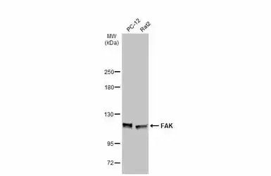 FAK antibody