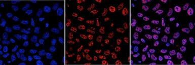 5-Methylcytosine / 5-mC antibo