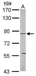 eEF2K antibody [N1N3]