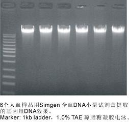 全血DNA小量试剂盒