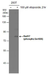 Rad17 (phospho Ser656) antibod