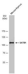 SATB1 antibody