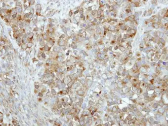 RAB17 antibody [N1C3]