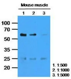 Calsequestrin 2 antibody [AT4E