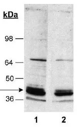 Sodium/Potassium ATPase beta 1