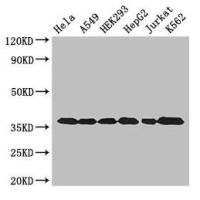 GAPDH Antibody|GAPDH抗体|WB内参抗体