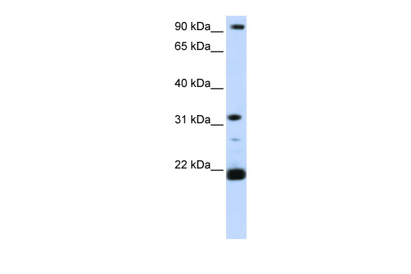 SNF8 antibody - C-terminal region (ARP57949_P050) in Human HeLa using Western Blot