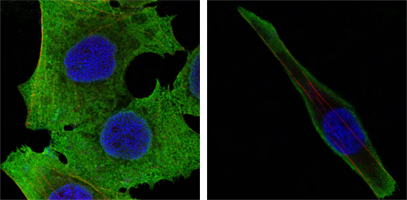 SOD1 Antibody (OAEC04511) in PANC-1 (left) and SKBR-3 (right) using Immunofluorescence