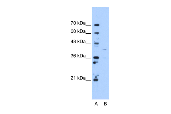 OAT antibody - C-terminal region (ARP48135_T100) in Human HepG2 using Western Blot