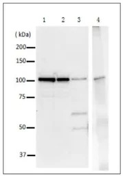 DNA Polymerase I (E coli) anti