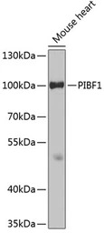 PIBF1 antibody