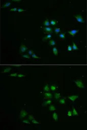 PPOX antibody