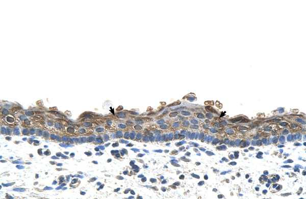 SLC26A1 antibody - C-terminal region (ARP44028_P050) in Human Skin using Immunohistochemistry