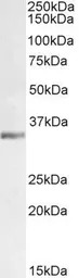 Lactate Dehydrogenase C (aa 22