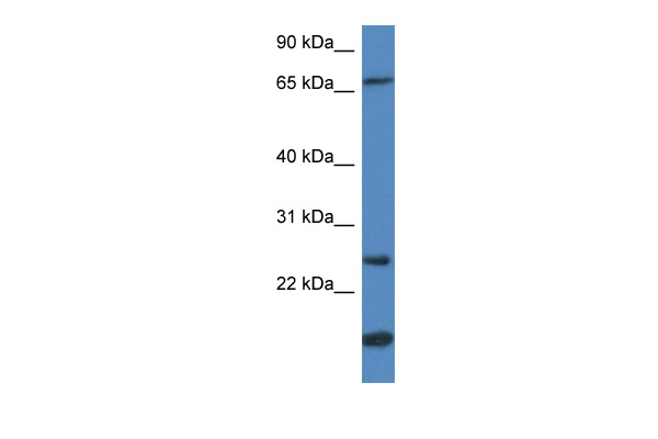 GSTM5 antibody - N-terminal region (ARP48485_P050) in Human Muscle using Western Blot