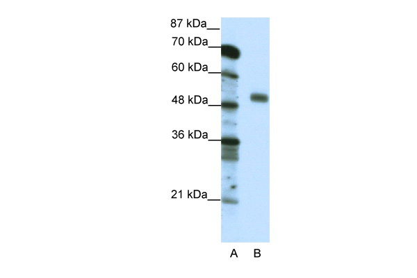 NFYC antibody - C-terminal region (P100681_P050) in Human Jurkat using Western Blot