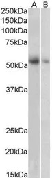 VMAT2 antibody, C-term