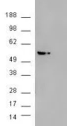 AKT3 antibody, Internal