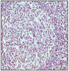 CD19 Antibody (OAAD00406) in Human normal lymph node using Immunohistochemistry