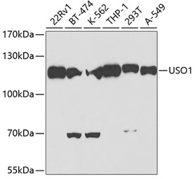VDP / p115 antibody