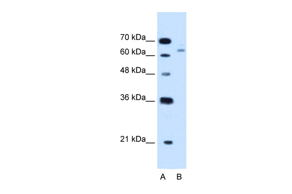 CBS antibody - N-terminal region (ARP45746_T100) in Human HepG2 using Western Blot