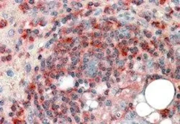 ARPC2 antibody, C-term