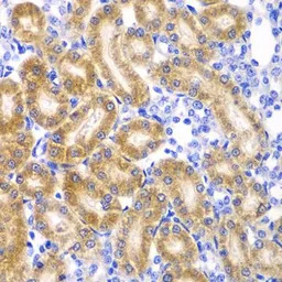 Ribophorin I antibody