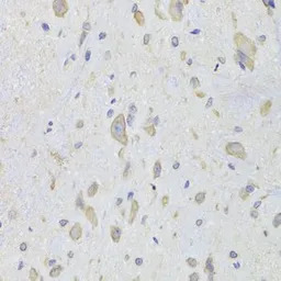EEF1B2 antibody