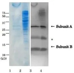 E. coli LT toxin antibody