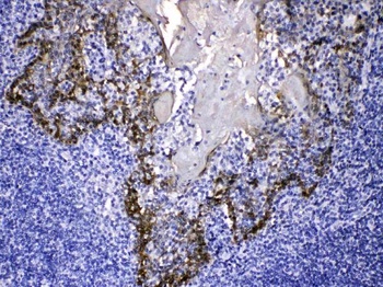 Cytokeratin 14/KRT14 Antibody 