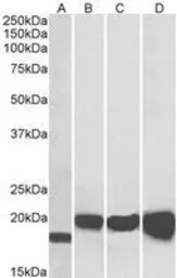 SOD1 antibody, Internal