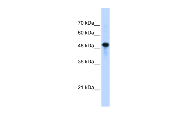 SEPT10(septin 10) antibody - C-terminal region (ARP48438_T100) in Human Jurkat using Western Blot