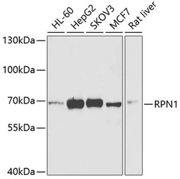 Ribophorin I antibody