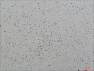 Cav3.3 Rabbit Polyclonal Antib