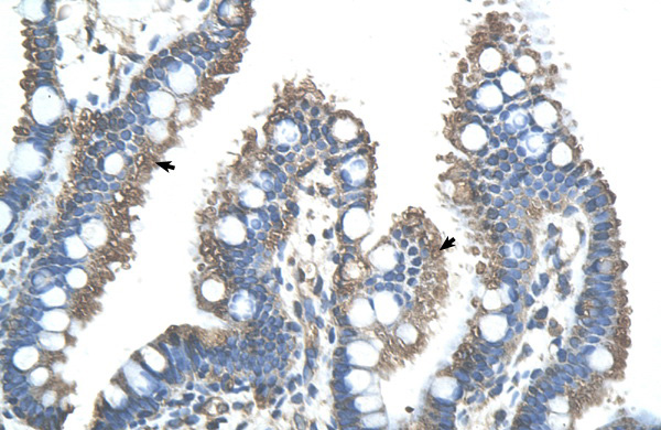 RNF121 antibody - N-terminal region (ARP43252_T100) in Human Intestine using Immunohistochemistry