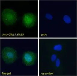 Clik1 / STK35 antibody, C-term