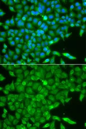 Casein Kinase 1 gamma 2 antibo