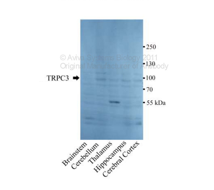 TRPC3 antibody - N-terminal region (ARP58715_P050) in Mouse brain using Western Blot